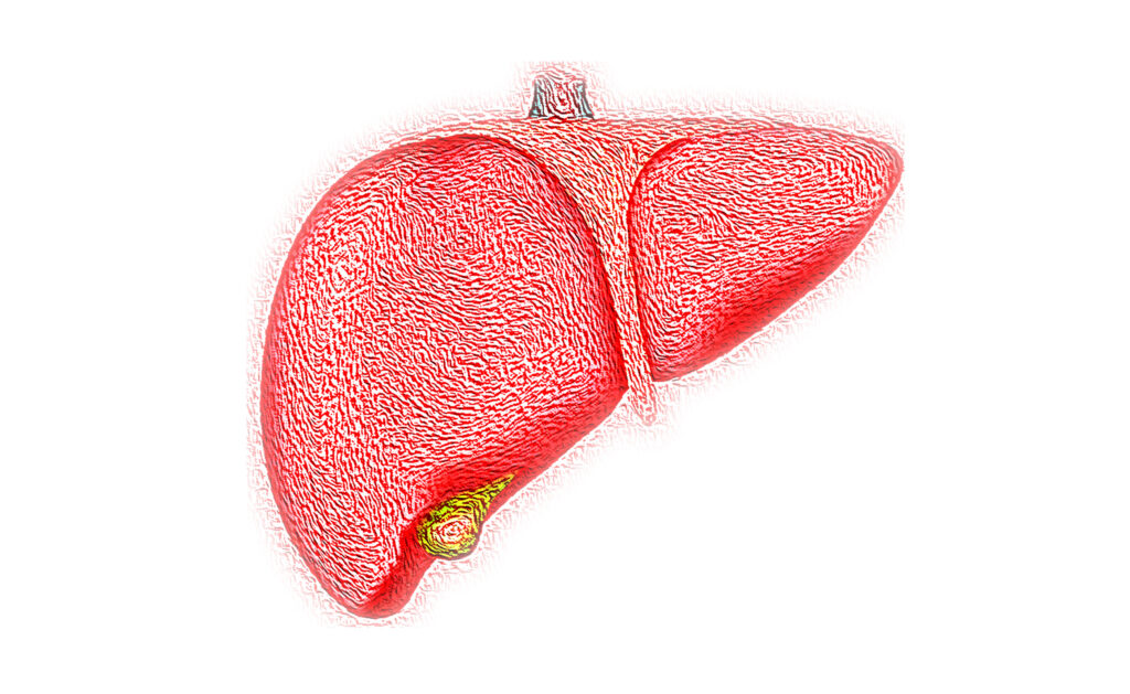 nash-liver-treatment-stocks