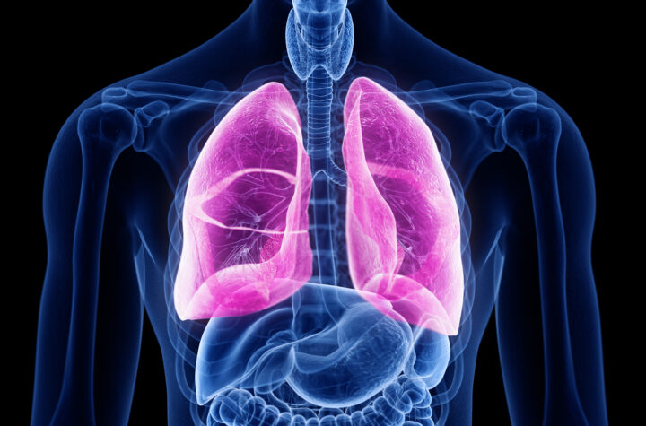 vertex pharmaceuticals cystic fibrosis stock