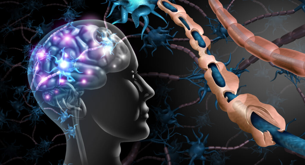 multiple sclerosis biotech stocks